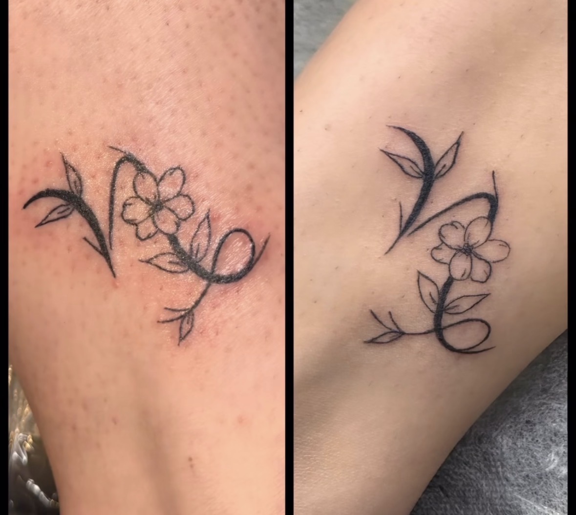 Blossom & Ribbon Ankle Pair